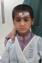 Wali Before treatment