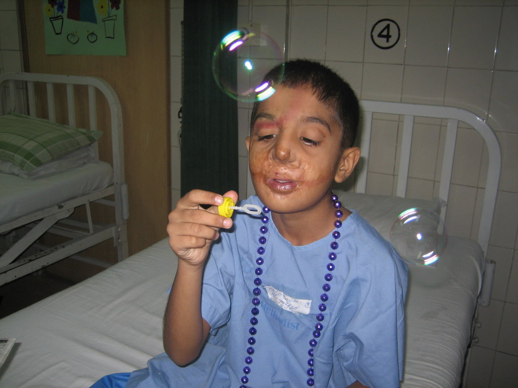 How to Share Medical Treatment for 100 Burn Children GlobalGiving