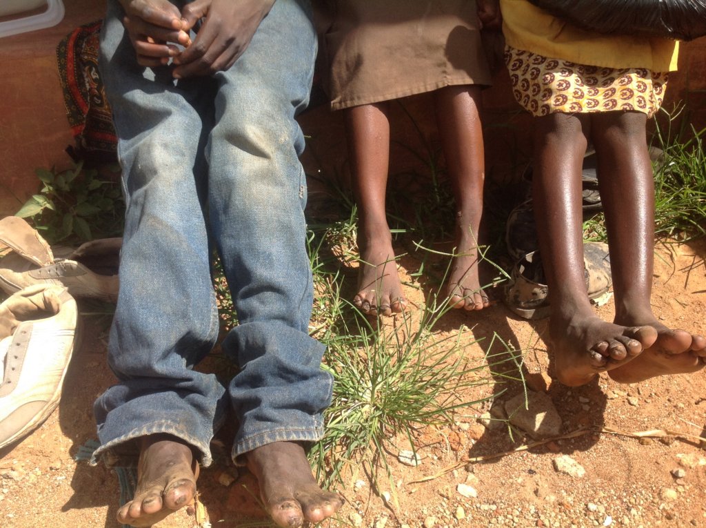 How to Share Eradicate jiggers among 500 children in Bungoma GlobalGiving