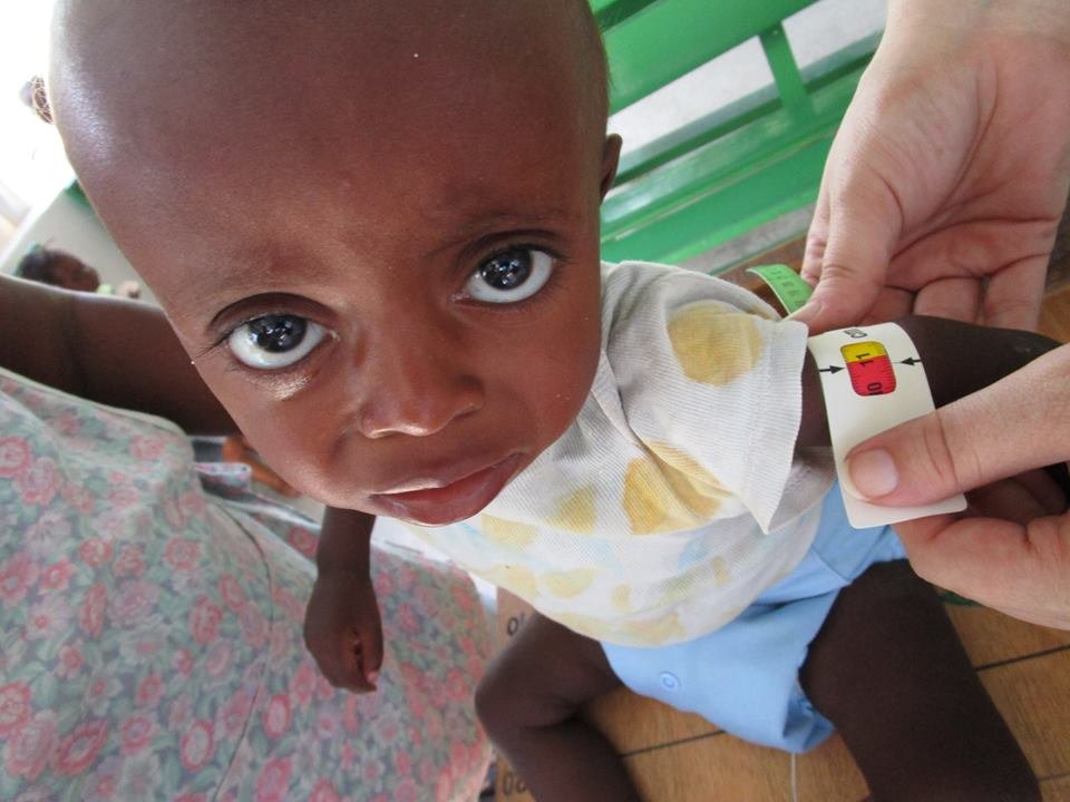 Prevent Disease Spread in Children in the ICU GlobalGiving