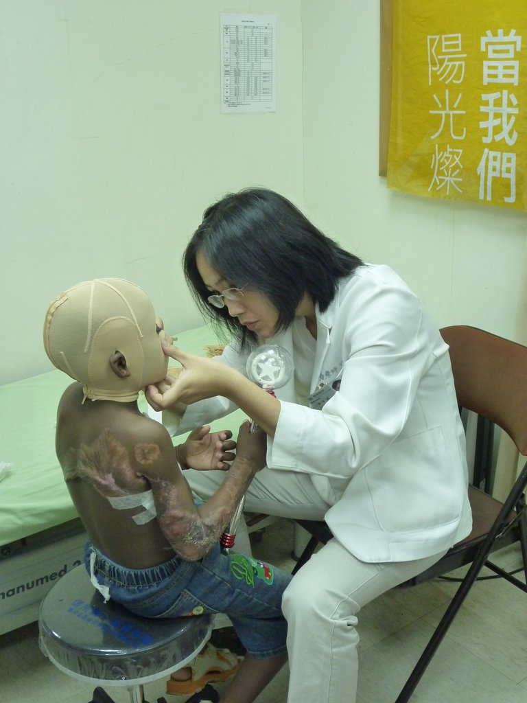 Give burn survivors access to rehabilitation GlobalGiving