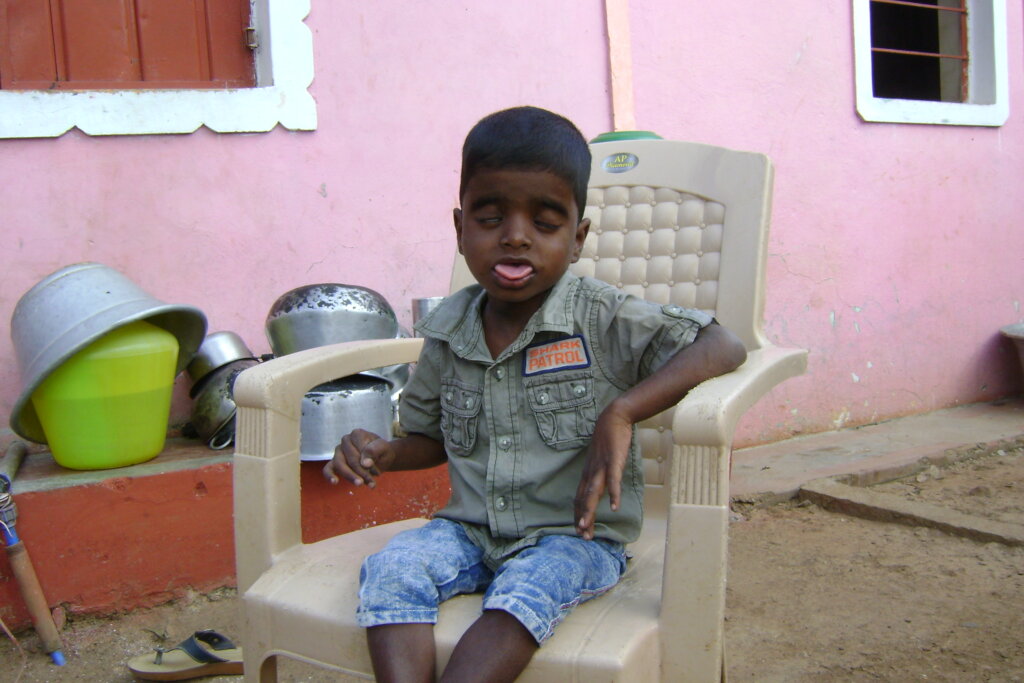 TWO DISABLED CHILDREN FROM A FAMILY NEED YOUR HELP GlobalGiving