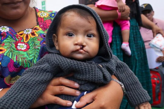 Support Cleft & Palate Nutrition in Rural Guatemal