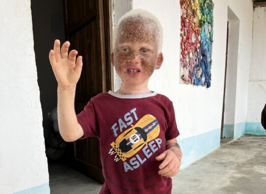 Luz - Sunscreen for Children with Albinism