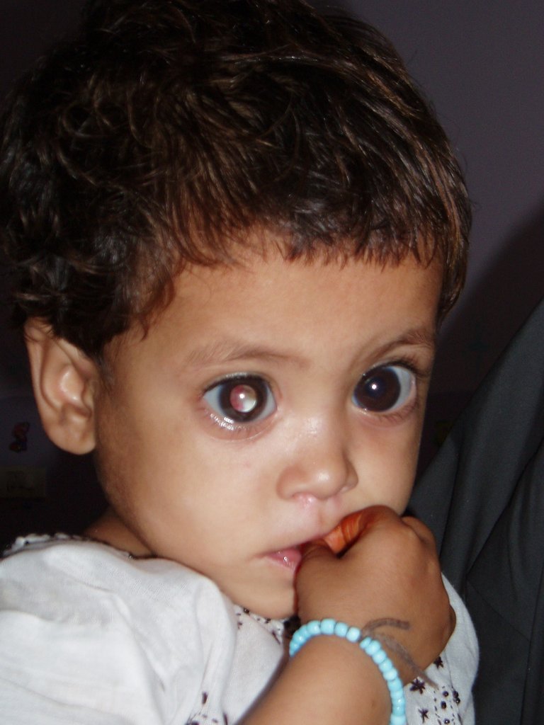 Reports on Help the poor blind children in Pakistan See! GlobalGiving